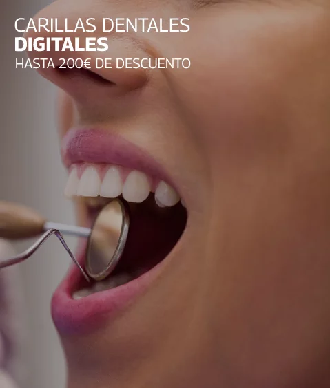 Carillas