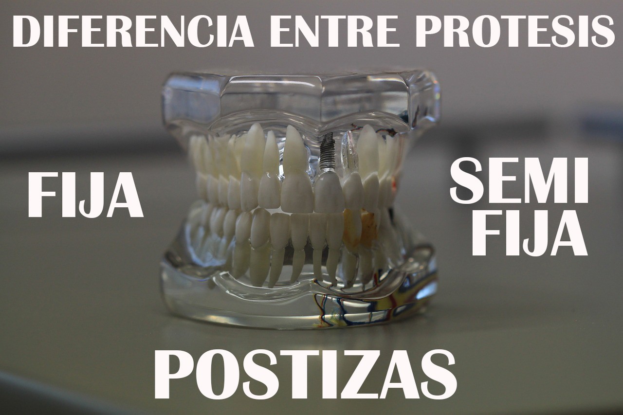 Difference between fixed, semi-fixed and artificial prostheses