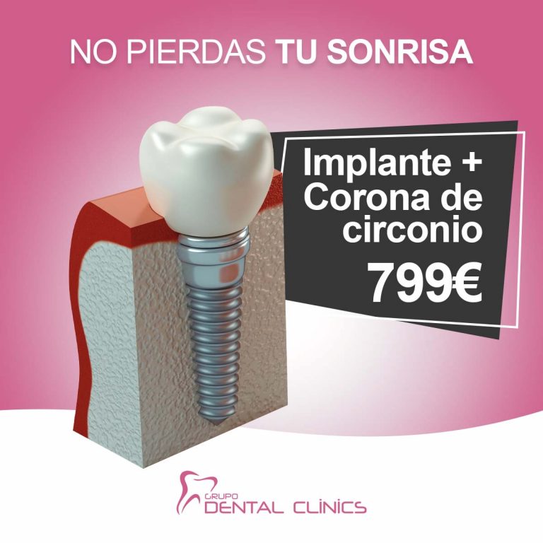 Implante + Corona Grupo Dental Clinics