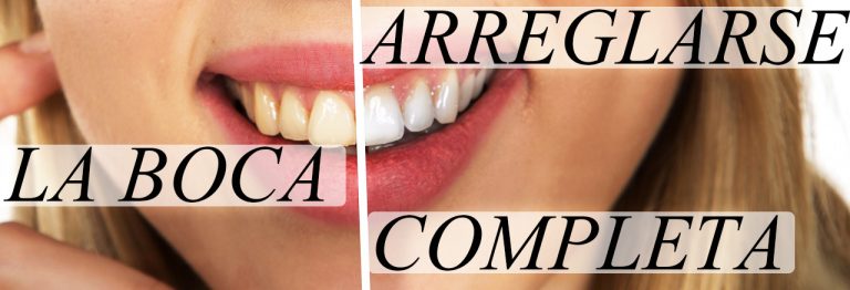 Que Significa Arreglarse La Boca Completa