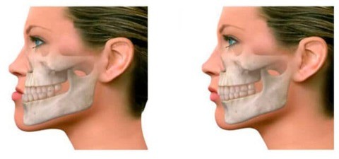 Cirugia Maxilofacial Resultados 640x300