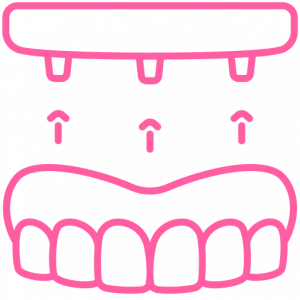 Dental Implant