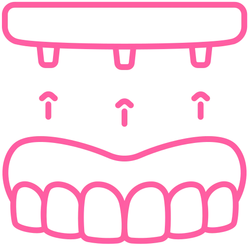 Dental Implant