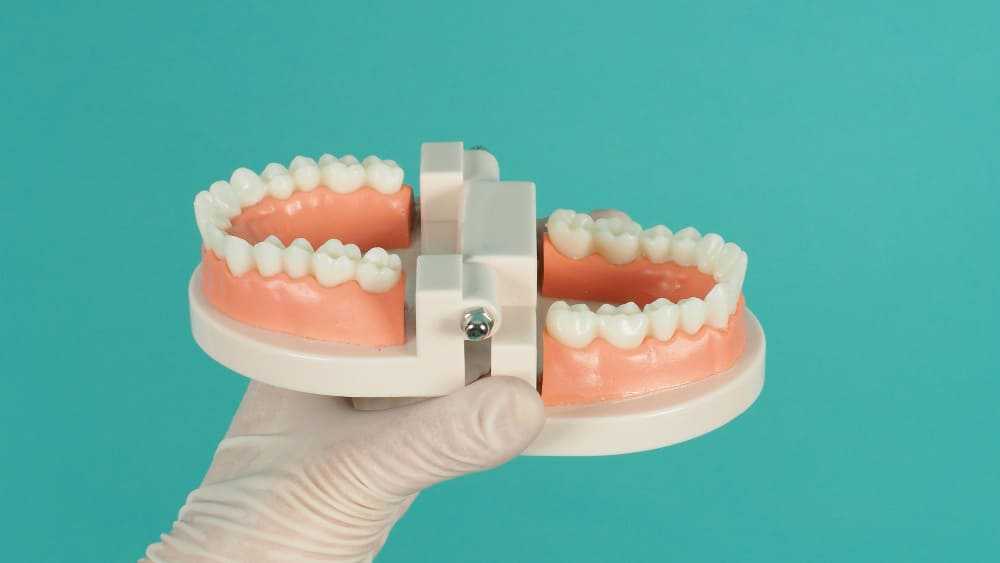 Dentista Mostrando Protesis Dental Removible Grupo Dental Clinics