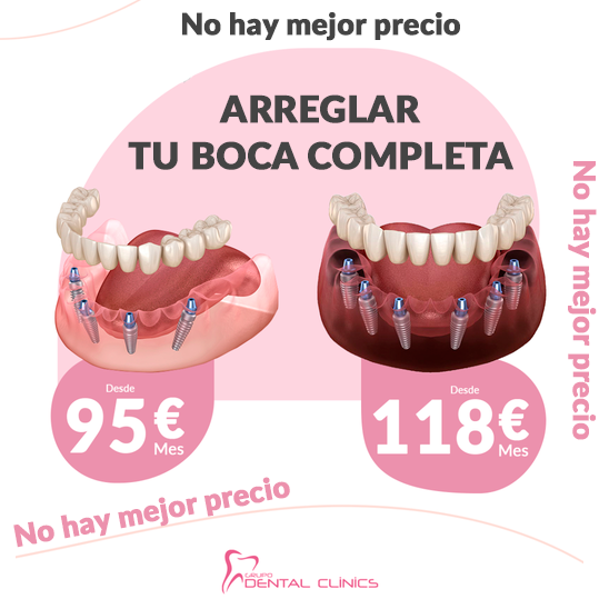 Fixed Teeth Prices