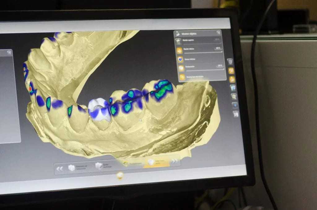 Laboratorio Grupo Dental Clinics Software Exocad (1)